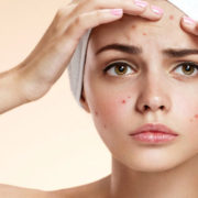 The best ingredients to combat acne-prone skin and bad skin days