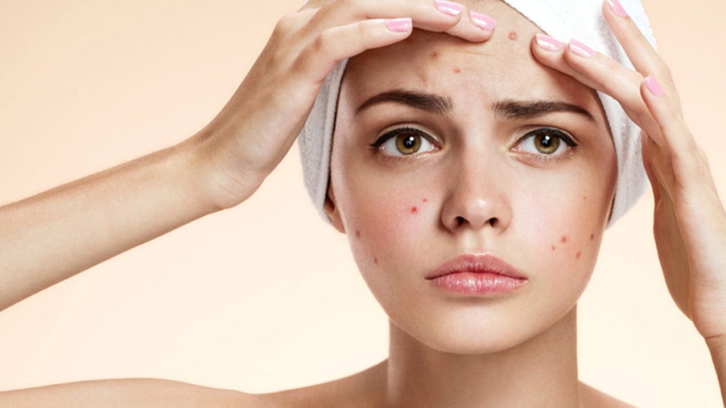 The best ingredients to combat acne-prone skin and bad skin days